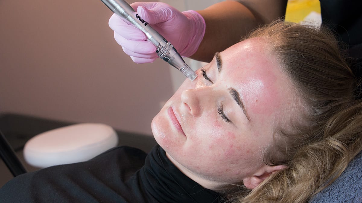 Vampire Package – PRP